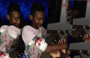 Si Ucok Ditebas Orang Tak Dikenal. Begini Kondisinya