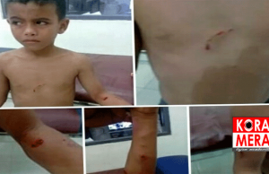 Warga Resah Anjing Liar Menyerang Anak dan Orang Dewasa